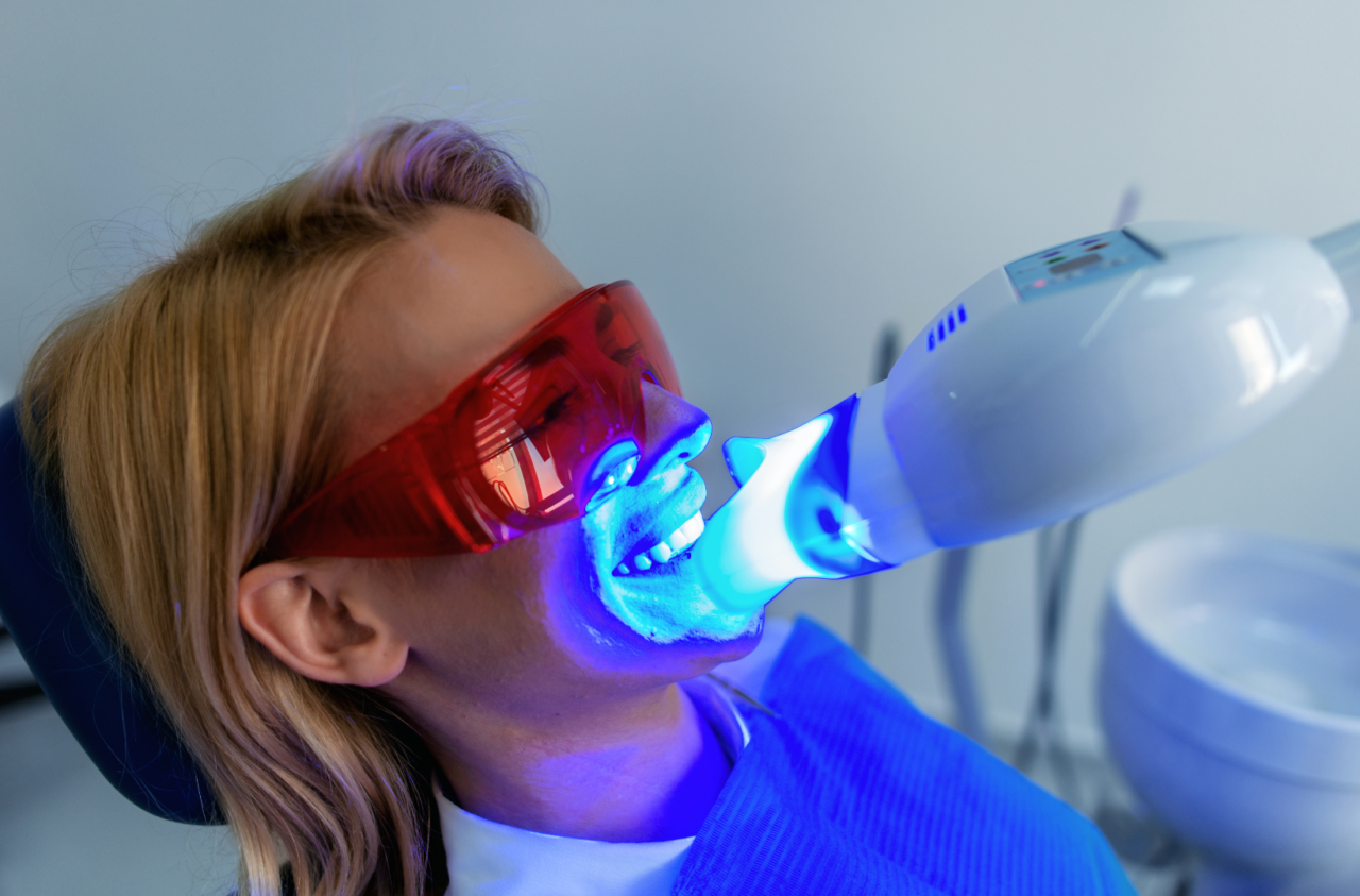 teeth whitening in chicopee ma