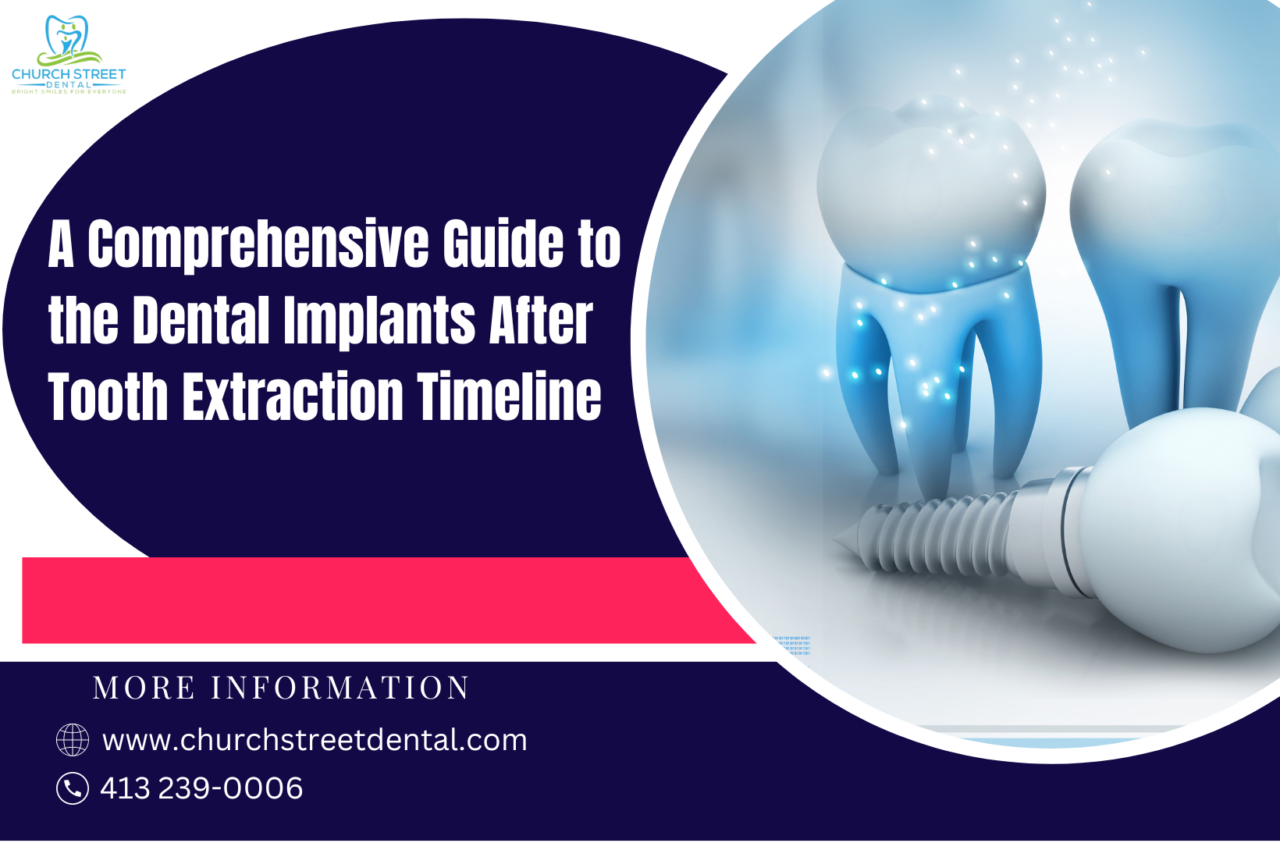Dental Implants After Tooth Extraction Timeline